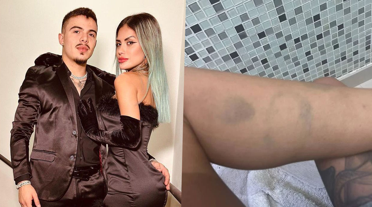 Fotos de Tati Zaqui ao lado de Thomaz Costa. À direita, imagens das agressões que o ator fez contra ela.